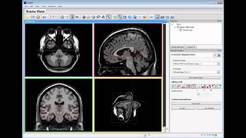Clinical Reports and Interactive Segmentation in GIMIAS