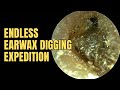 Endless Earwax Digging Expedition