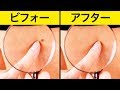 自然にイボを取り除く効果的な１０の方法