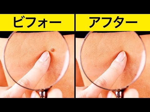 自然にイボを取り除く効果的な１０の方法