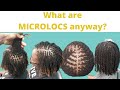 Microlocs Explained!