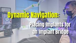 This Changed How I Place Implants Forever: Using X-Guide Dynamic Navigation for Implant Bridge