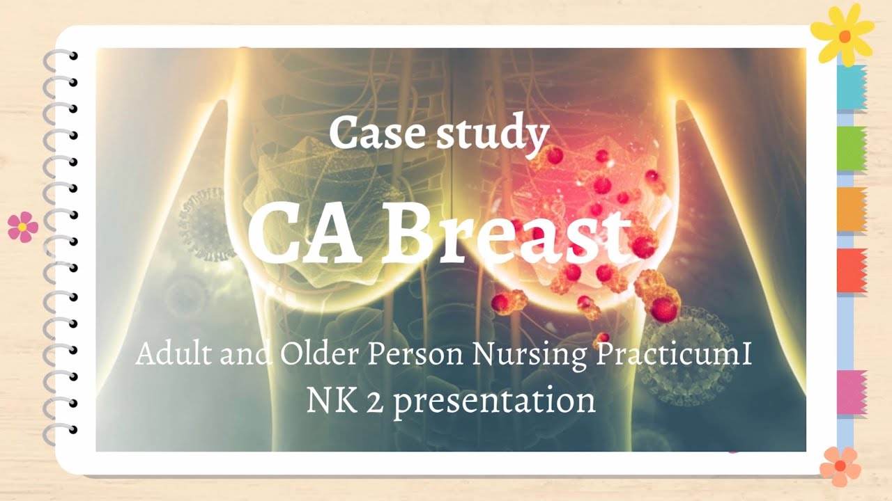 Case study CA Breast NK 2 - YouTube
