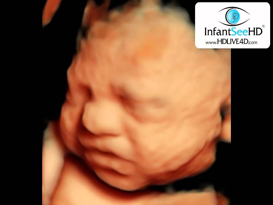 baby mad? 28 WEEKS IN THE WOMB HDLIVE 4D ULTRASOUND - YouTube