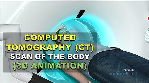 WHAT IS COMPUTERIZED TOMOGRAPHY (CT)? | (THE BEST EXPLAINED!!)