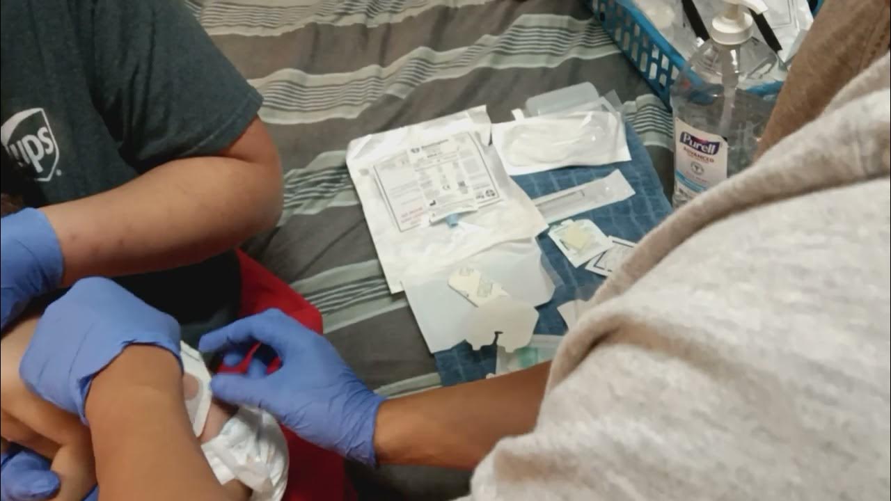 A parent's experience while changing infant bilateral nephrostomy tubes