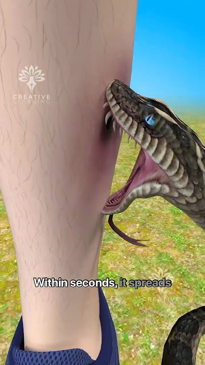 What Happens Inside Your Body When a Snake Bites You #snakebite #short - Creativelearning3d