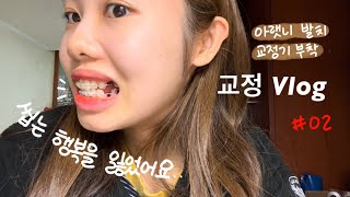 교정 Vlogㅣ교정기 풀장착하고 찐 교정인으로 변신ㅣ발치 교정 한달차, 교정하면 강제다이어트 ??