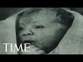 What It Was Like To Grow Up As The World's First 'Test-Tube Baby' | TIME Mp3