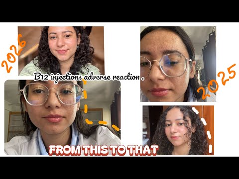 adverse reactions to b12 injections YouTube Platinum Peptides UK -