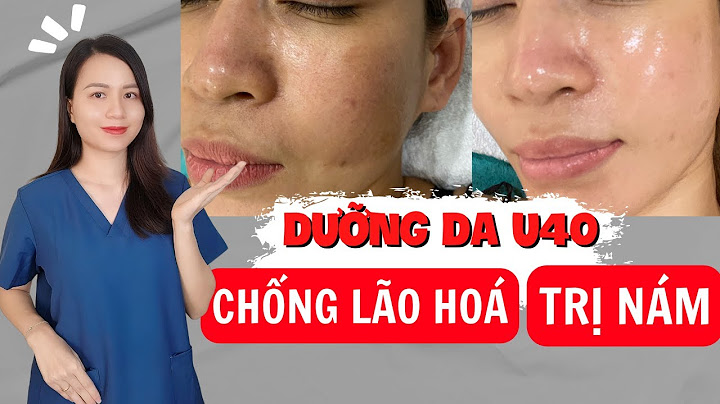 Kem nào chống lão hoá và tàn nhang tốt nhất năm 2024