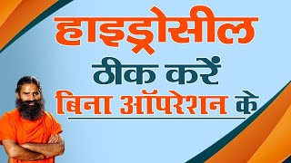 हाइड्रोसील ठीक करें बिना ऑपरेशन के || Swami Ramdev