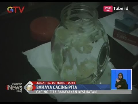 Video: Di Otak Seorang Gadis 8 Tahun, Lebih Dari 100 Larva Cacing Pita Ditemukan - Pandangan Alternatif