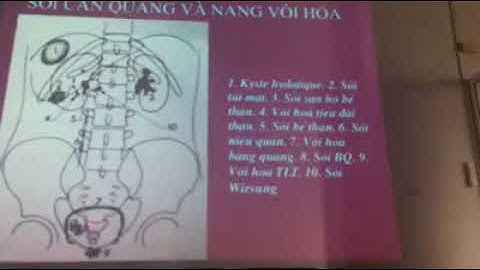 [2H SWEETHOME] CĐHA cấp cứu bụng không chấn thương | PGS.TS. Trần Công Hoan