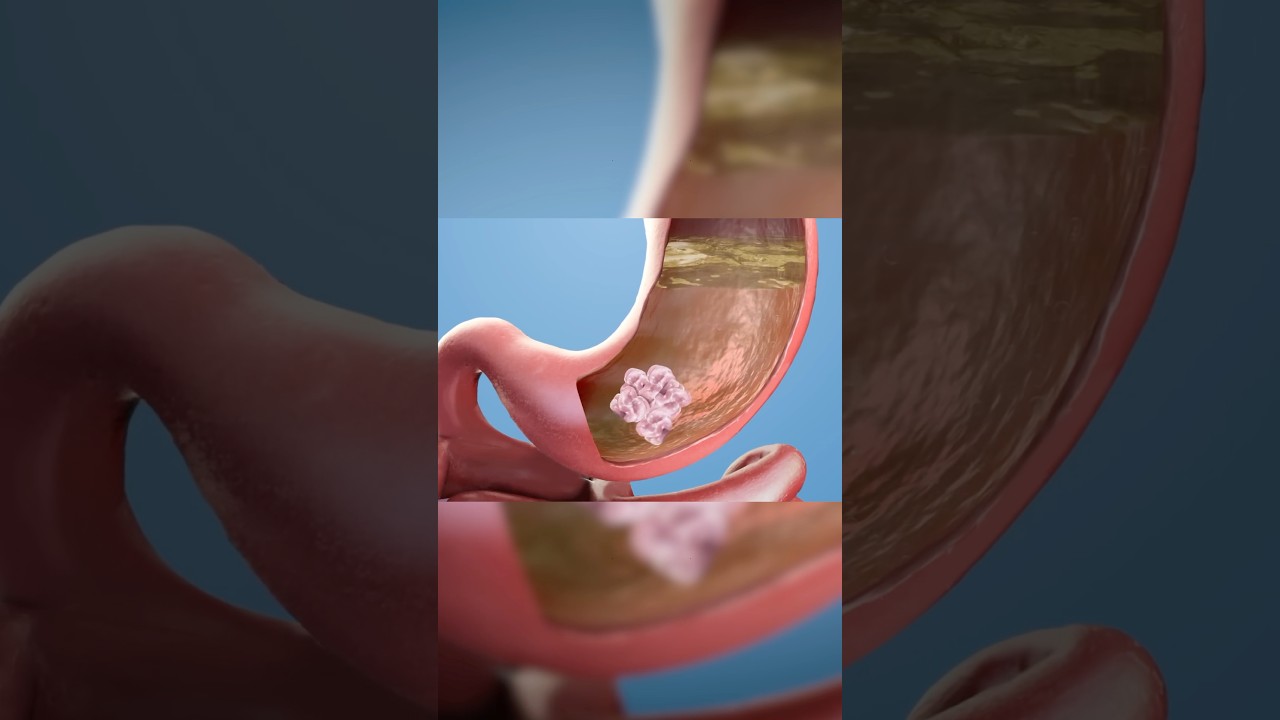 What Happens When You Swallow a Bubble? 🤔