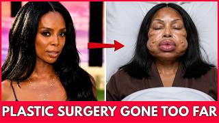 14 Black Hollywood Stars Whose Plastic Surgery Changed Everything | Then and Now 2026