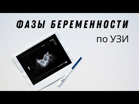 Видео: В оплодена ембрионална торбичка?