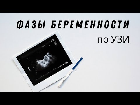 Video: Kur randamas endometriumas?