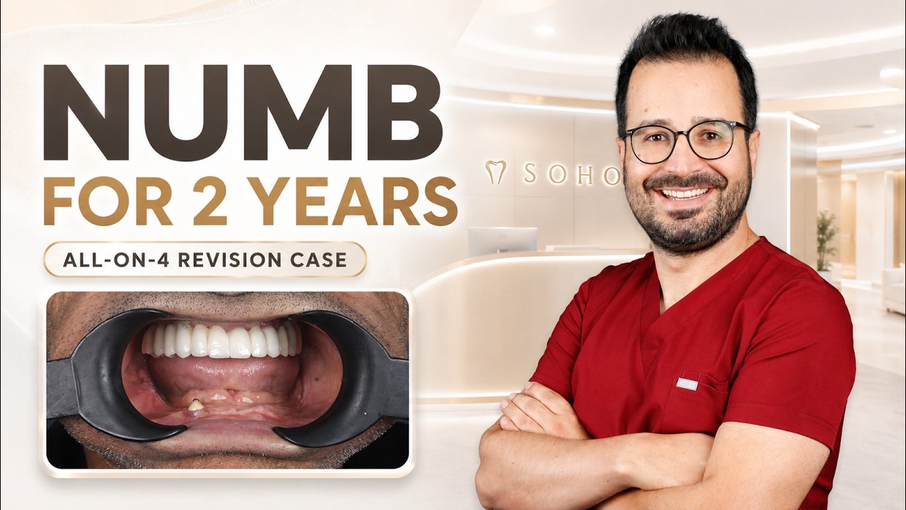 Dental Implant Nerve Complication in Istanbul: 2 Years of Lip Numbness | All-on-4 Revision