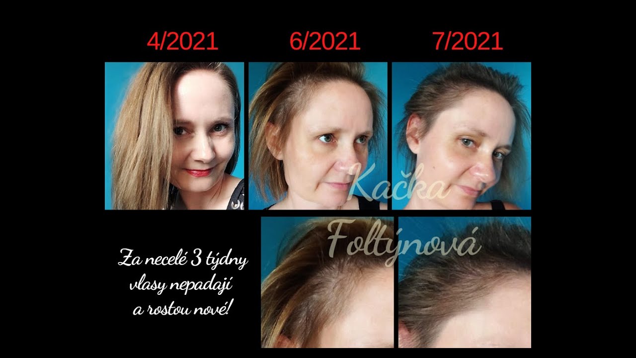 Padání vlasů/proměna za 3 týdny