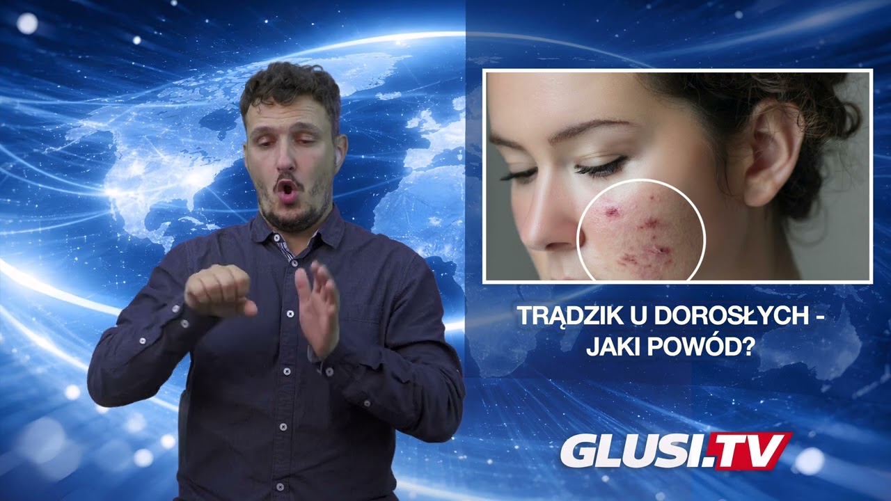 Trądzik u dorosłych - jaki powód?