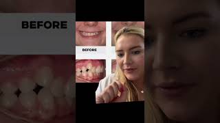 On Another Episode Of How Long Will This Treatment Take?