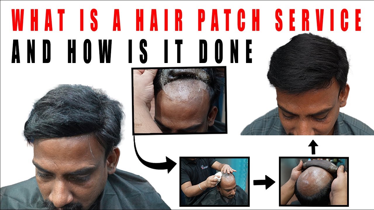 Skin Base Hair Patch System | 100% Natural Look | Best hair patch service