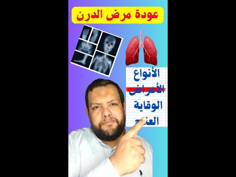 عودة الدرن 13