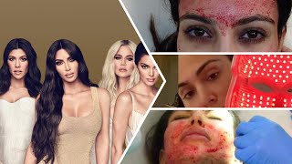 The 15 Craziest Things The Kardashians Have Done To Beauty Treatments
