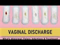 leukorrhea (vaginal discharge): Normal Ya Problem?"#womenhealthrips