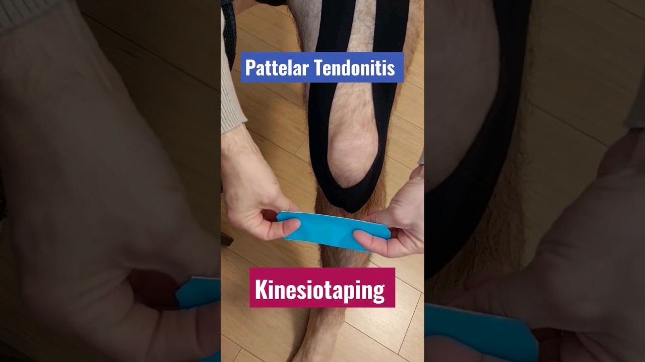 Patellar Tendonitis Taping  Kinesio Tape for Patellar Tendonitis – KT Tape