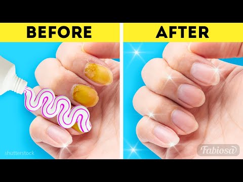 Como cuidar de suas unhas? hacks DIY inteligentes para unhas saudáveis ​​e mãos macias