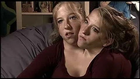 Abigail & Brittany Hensel - The Twins Who Share a Body - DayDayNews