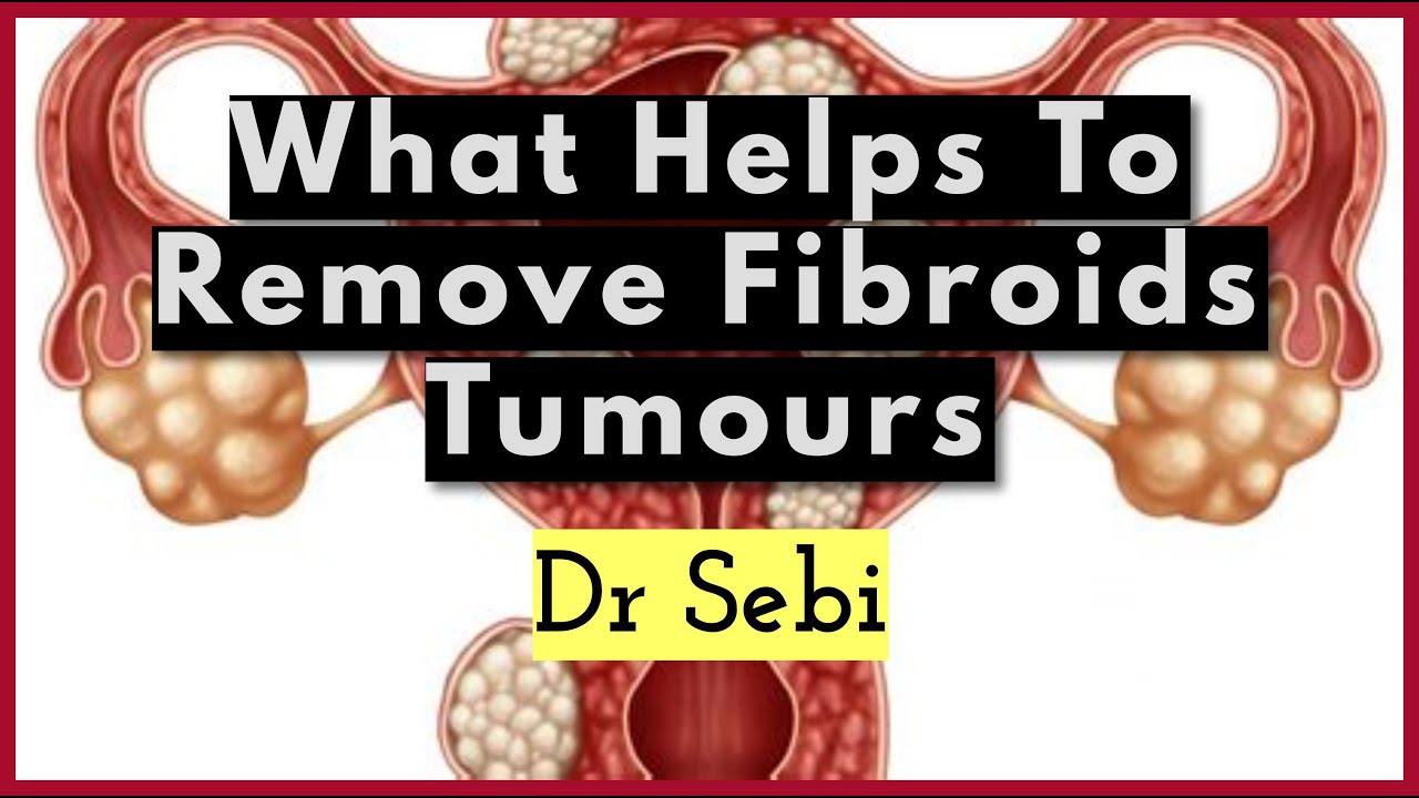 DR SEBI MANIPULATION & FIBROIDS POTASSIUM PHOSPHATE DIBASIC YouTube