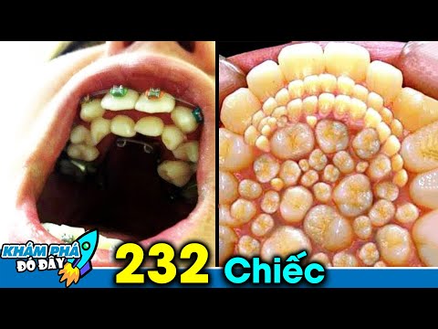 Video: Man sử dụng lỗ hổng để trả 300 đô la cho chuyến bay hạng nhất vòng quanh thế giới Epic trị giá 60.000 đô la