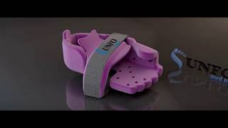 UNFO med Ltd- The most advanced treatment for Metatarsus adductus