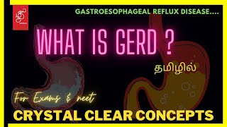 GASTROESOPHAGEAL REFLUX DISEASE | GERD IN TAMIL| HEART BURN REASONGERD MEDICINE GASTRIC INTAMIL