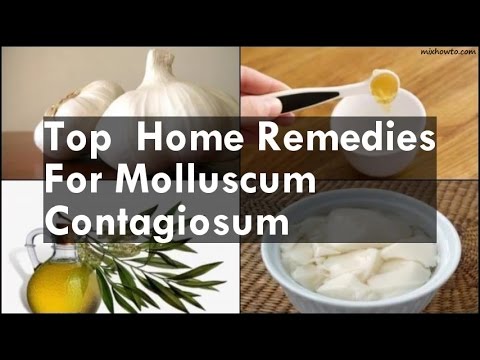 Home Remedies For Molluscum Contagiosum