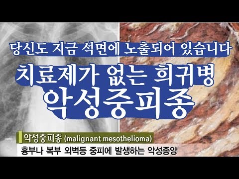 희귀암 악성종피종이 뭐길래?? tv는 사랑을 싣고 송준근 친구편 中