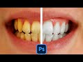 How to Remove Yellow Teeth and Whiten Teeth in Photoshop (Step-by-Step Tutorial)