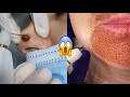 Most Extreme Beauty Treatments 2021 Best Smart and Helpful Beauty Hacks | Virtual Beauty