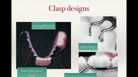 16. Interim Removable Partial Dentures