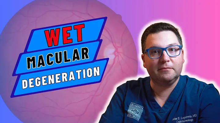 Wet Age-Related Macular Degeneration (AMD) Explained by MD