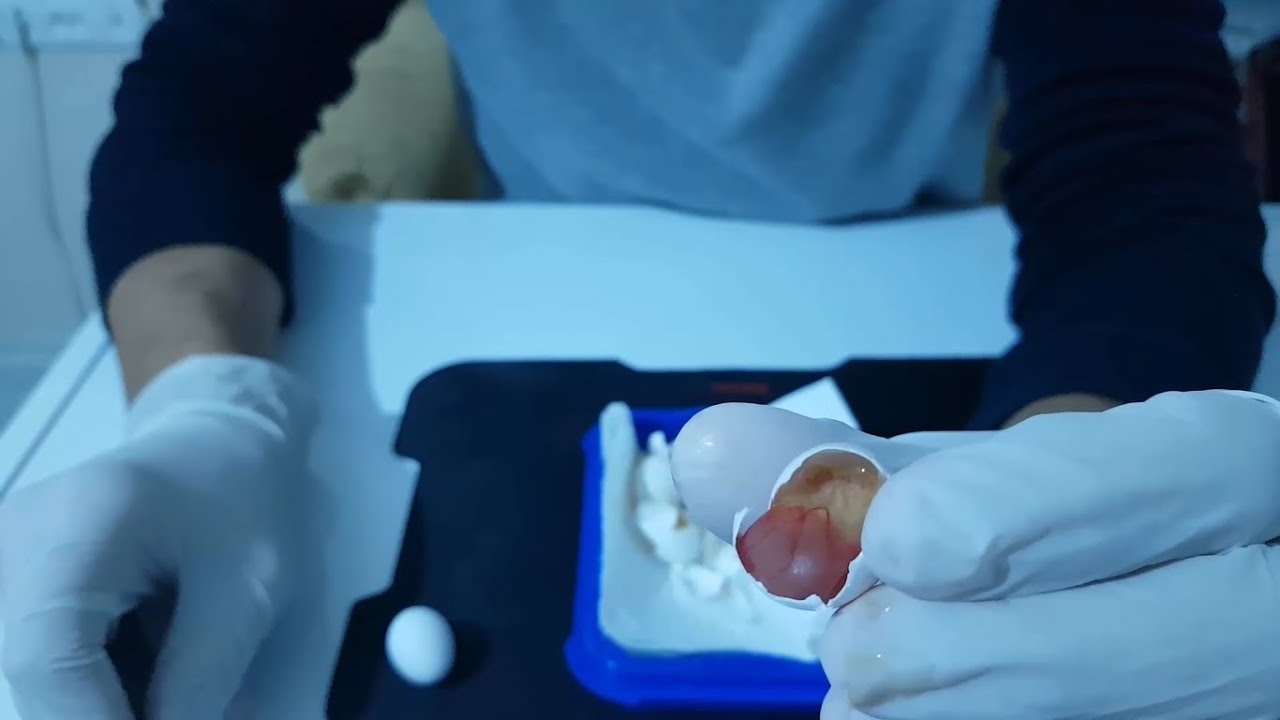 Yumurta Doluluk Kontrolü Yaptık (13 Günlük Yavru Çıktı)