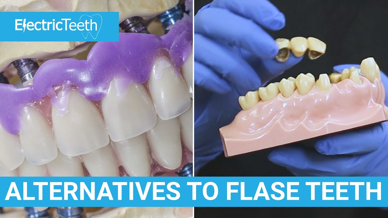 Alternative treatments to dentures & false teeth