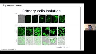 Kidney tubulointerstitium: a microfluidic bioprinting approach