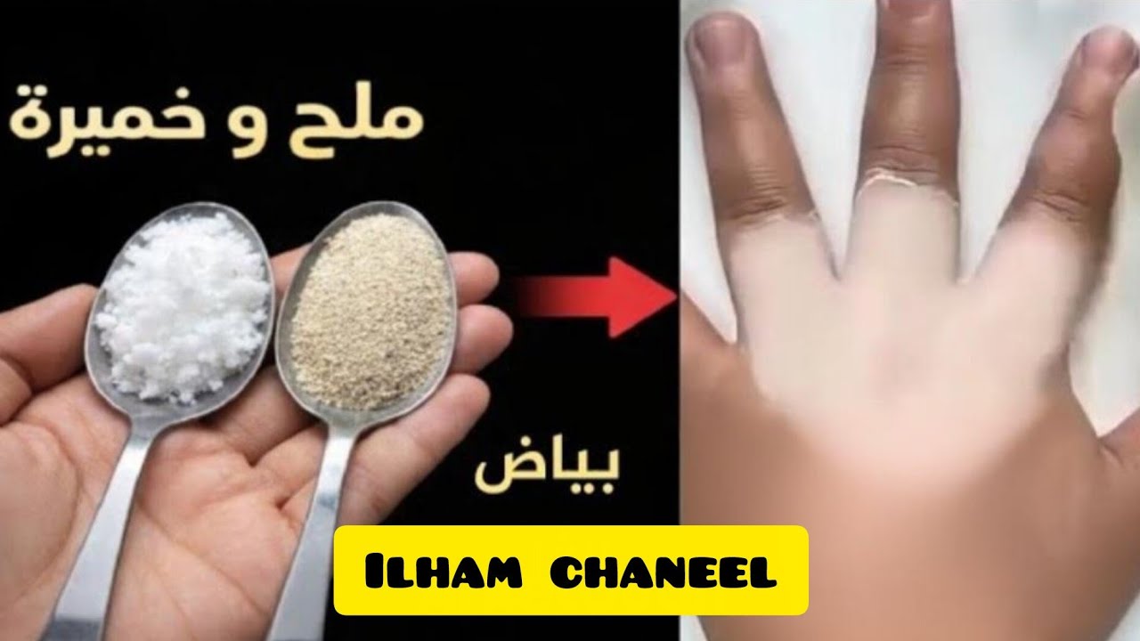 الخميرة والملح‼️ يزيل سواد 20 سنه💥 تبييض الوجه والجسم والمناطق الحساسة في 5 دقائق فقط ‼️