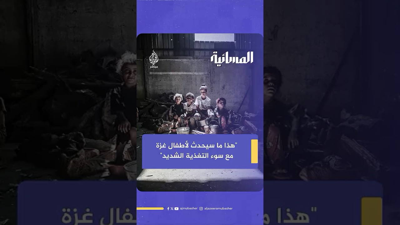 هذا ما سيحدث بعد مرور 4 أسابيع من حصول سوء التغذية الشديد لدى الأطفال