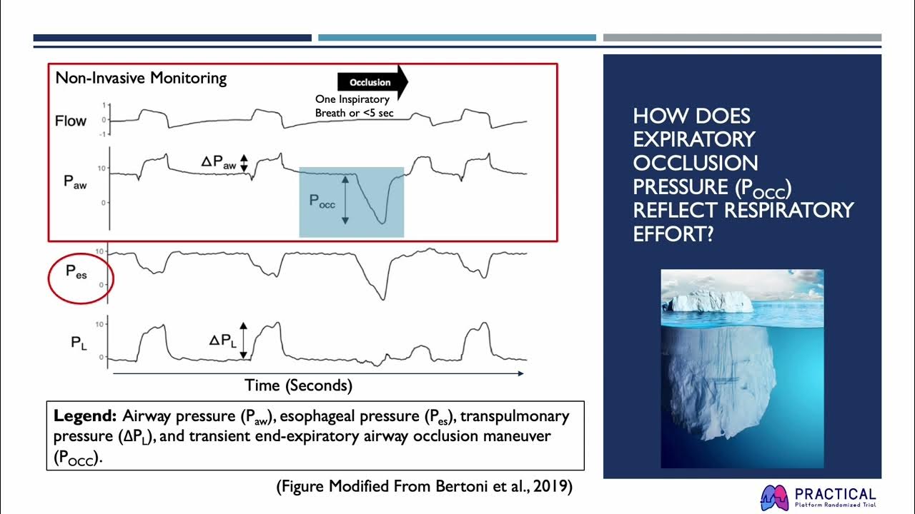 Measuring Pocc (Expiratory Occlusion Pressure) YouTube