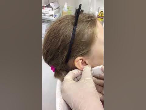ПРОКОЛОТЬ УШИ РЕБЕНКУ - YouTube